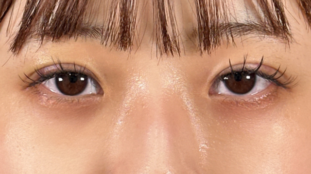 Postoperative Condition Part 1