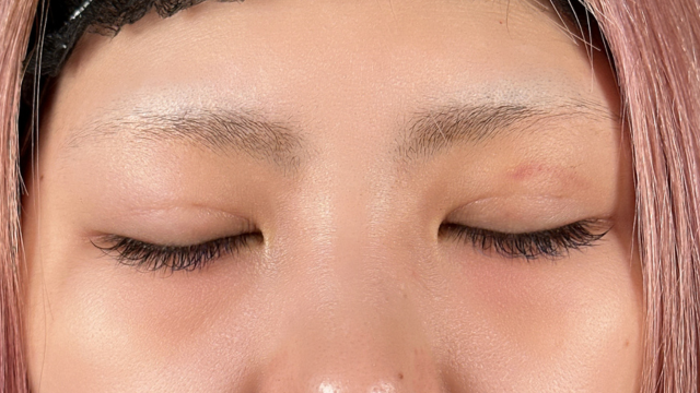 Postoperative Condition Part 1