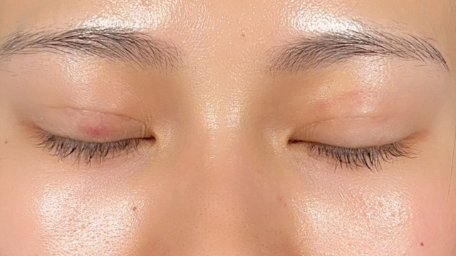 Postoperative Condition Part 1