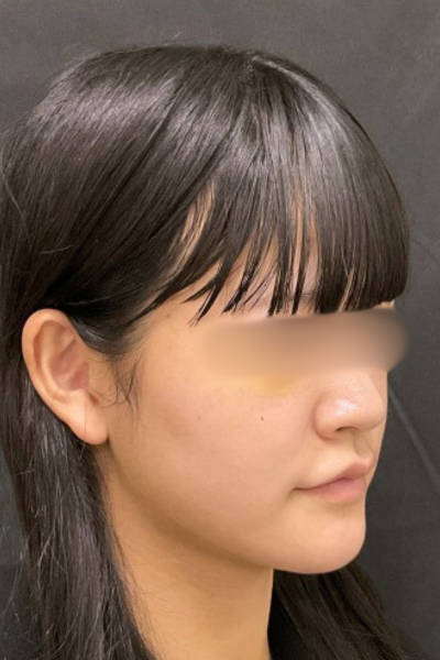 手術前の状態 その1