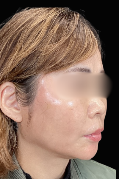 Postoperative Condition Part 1