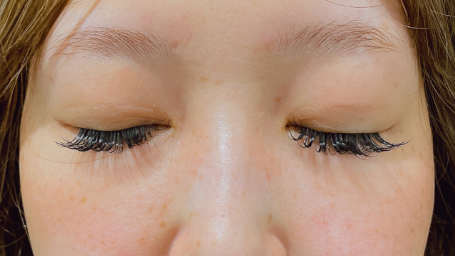 Postoperative Condition Part 1