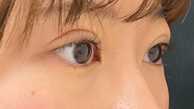 Postoperative Condition Part 1