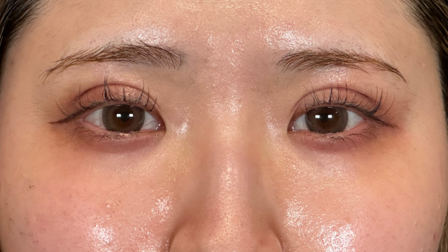 Postoperative Condition Part 1