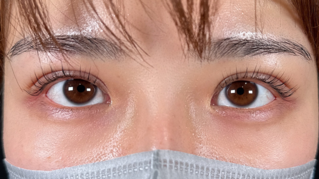 Postoperative Condition Part 1