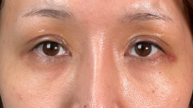 Postoperative Condition Part 1