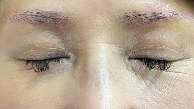 Postoperative Condition Part 1