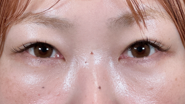 Postoperative Condition Part 1