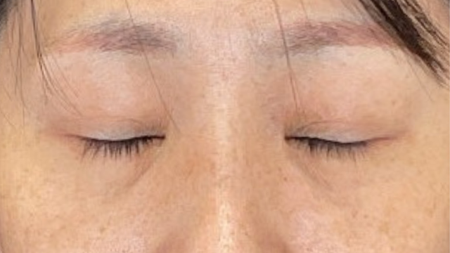 Postoperative Condition Part 1