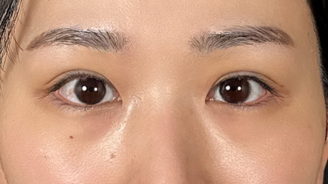 Postoperative Condition Part 1