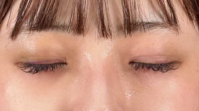 Postoperative Condition Part 1