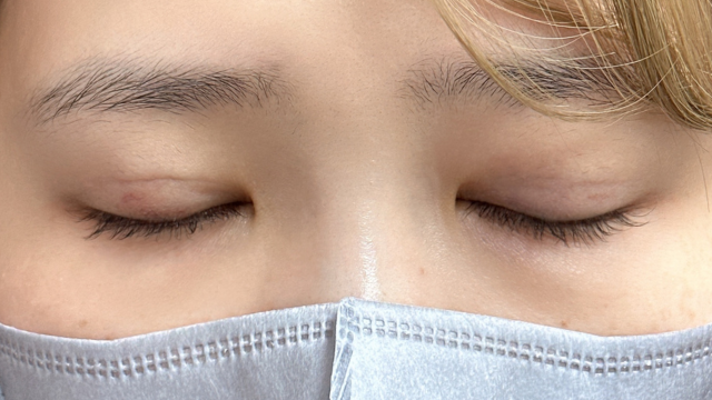 Postoperative Condition Part 1