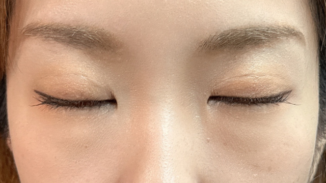 Postoperative Condition Part 1