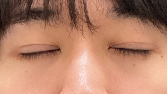 Postoperative Condition Part 1