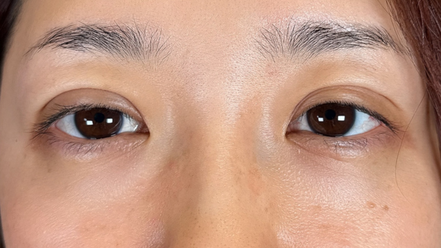 Postoperative Condition Part 1