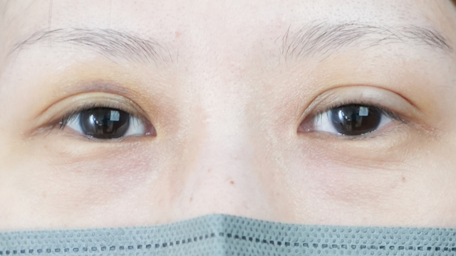 Postoperative Condition Part 1