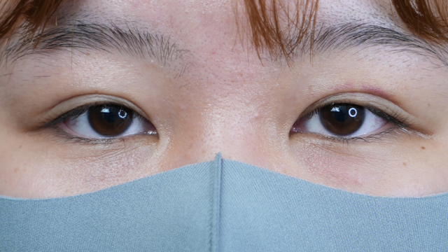 Postoperative Condition Part 1