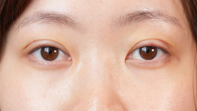 Postoperative Condition Part 1