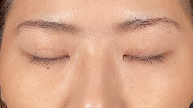 Postoperative Condition Part 1