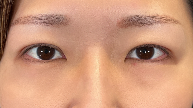 Postoperative Condition Part 1