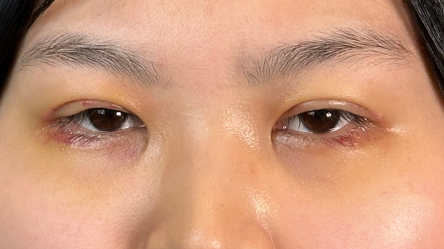 Postoperative Condition Part 1