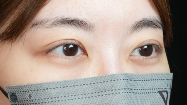 Postoperative Condition Part 1