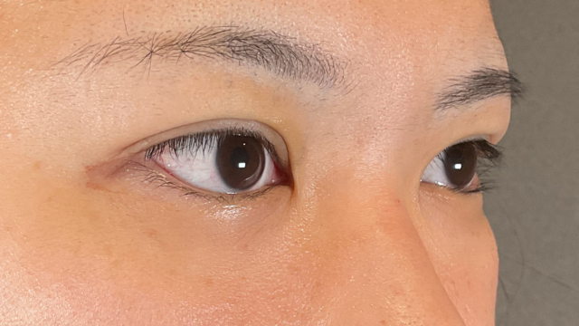 Postoperative Condition Part 1