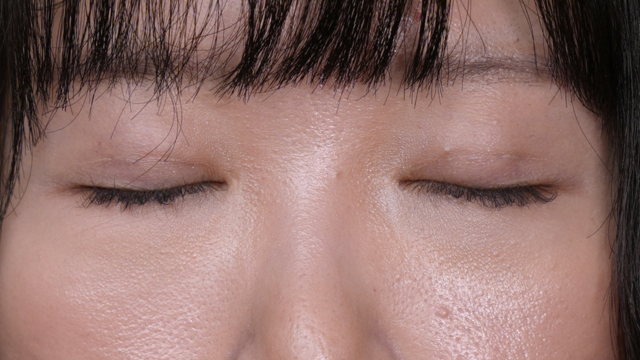 Postoperative Condition Part 1