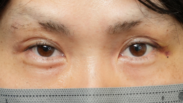 Postoperative Condition Part 1