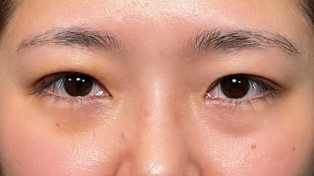 Postoperative Condition Part 1