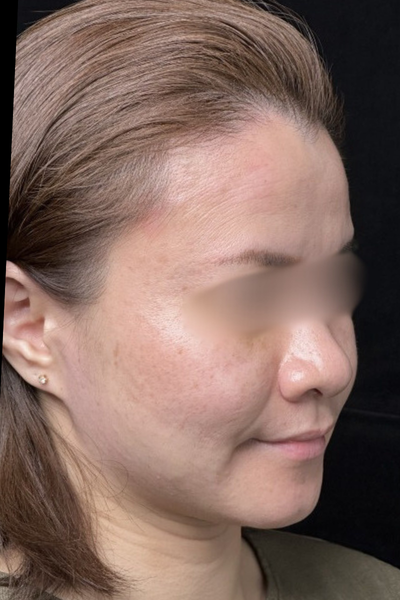 手術前の状態 その1