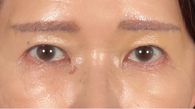 Postoperative Condition Part 1