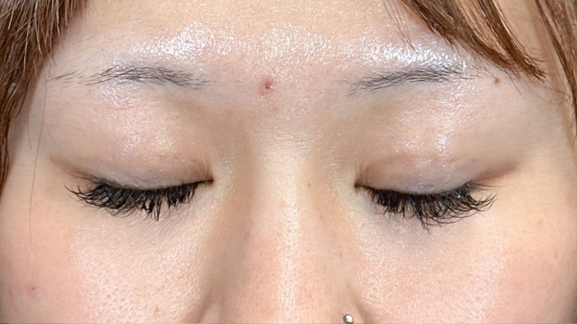 Postoperative Condition Part 1