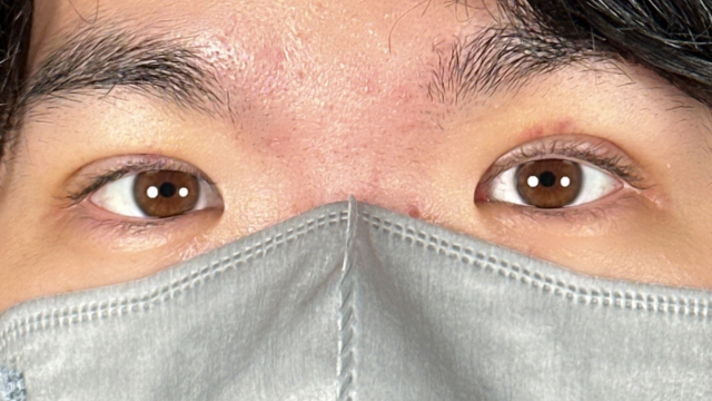 Postoperative Condition Part 1