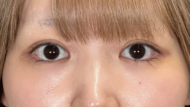 Postoperative Condition Part 1