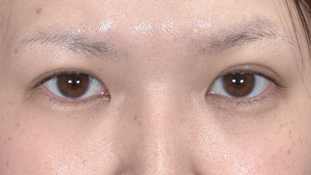 Postoperative Condition Part 1