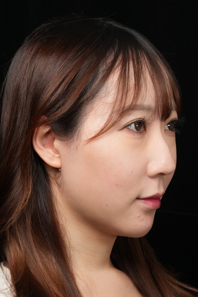 Postoperative Condition Part 1