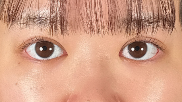 Postoperative Condition Part 1