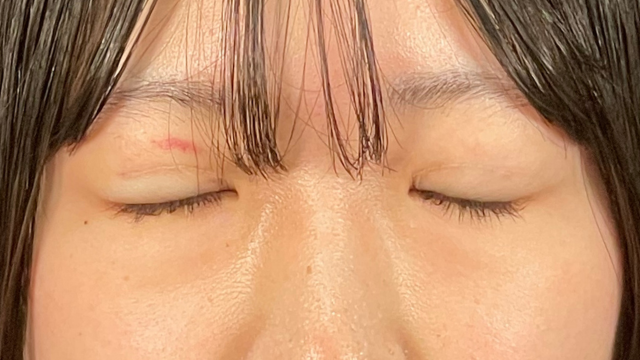 Postoperative Condition Part 1