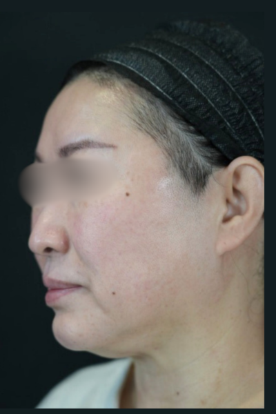 手術前の状態 その1