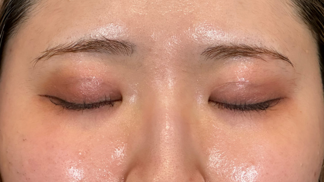 Postoperative Condition Part 1