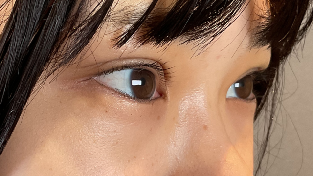 Postoperative Condition Part 1