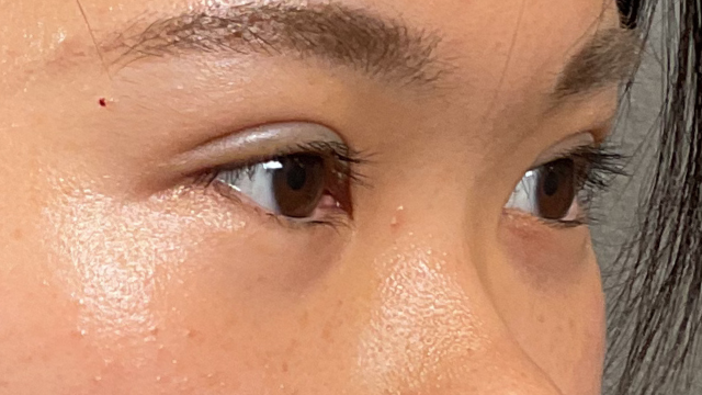 Postoperative Condition Part 1