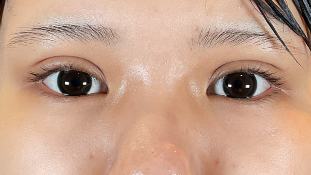 Postoperative Condition Part 1