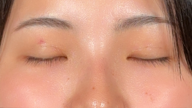 Postoperative Condition Part 1