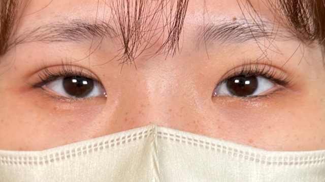 Postoperative Condition Part 1