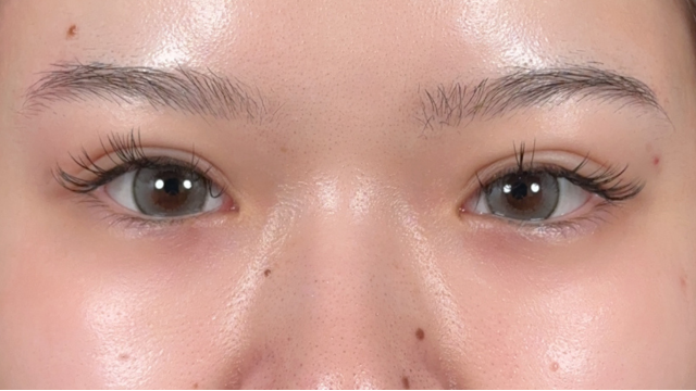 Postoperative Condition Part 1