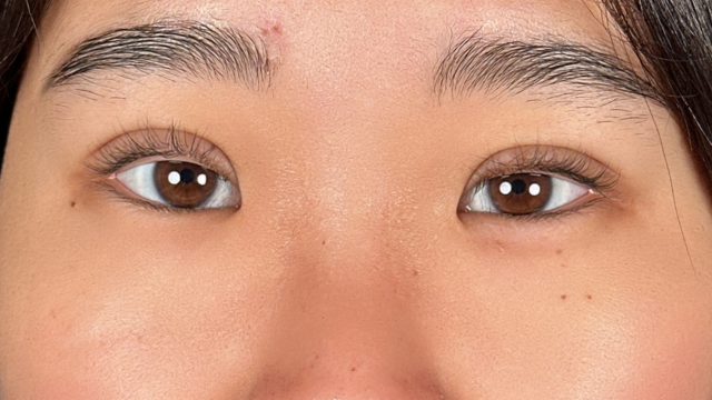 Postoperative Condition Part 1