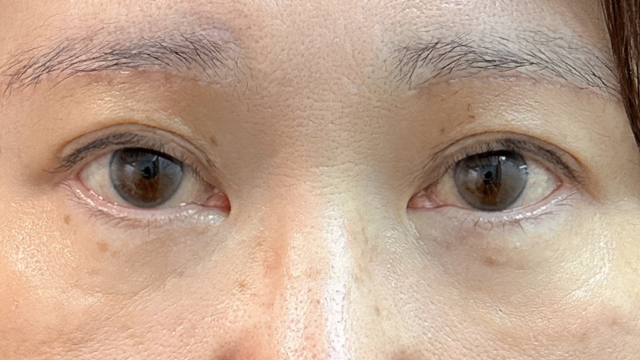 Postoperative Condition Part 1