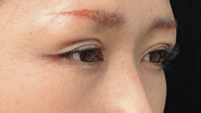 Postoperative Condition Part 1